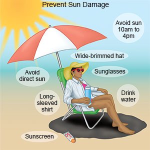 When exposed to strong sunlight, what are some ways to prevent sunburn?