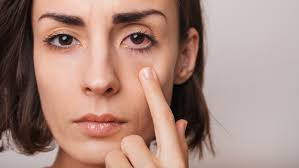 3 popular diseases that cause itchy eyes. Get treatment quickly